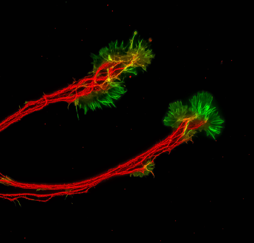 neurites-growth-cone.png